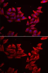 Anti-SFRP4 antibody used in Immunocytochemistry/ Immunofluorescence (ICC/IF). GTX33493