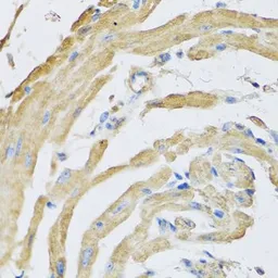 Anti-SFRP4 antibody used in IHC (Paraffin sections) (IHC-P). GTX33493