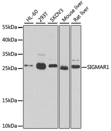 Anti-SIGMAR1 antibody used in Western Blot (WB). GTX33496