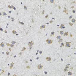 Anti-SIGMAR1 antibody used in IHC (Paraffin sections) (IHC-P). GTX33496