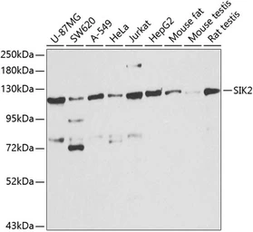 Anti-SIK2 antibody used in Western Blot (WB). GTX33497