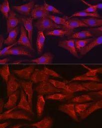 Anti-SIRT3 antibody used in Immunocytochemistry/ Immunofluorescence (ICC/IF). GTX33499