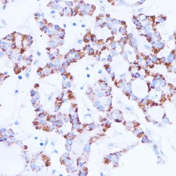 Anti-SIRT3 antibody used in IHC (Paraffin sections) (IHC-P). GTX33499