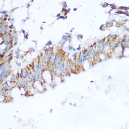 Anti-SIRT4 antibody used in IHC (Paraffin sections) (IHC-P). GTX33501