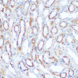 Anti-SIRT4 antibody used in IHC (Paraffin sections) (IHC-P). GTX33501