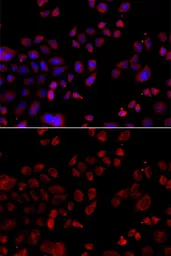 Anti-SLC22A11 antibody used in Immunocytochemistry/ Immunofluorescence (ICC/IF). GTX33503