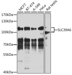 Anti-SLC39A6 antibody used in Western Blot (WB). GTX33505
