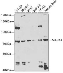 Anti-SLC3A1 antibody used in Western Blot (WB). GTX33506