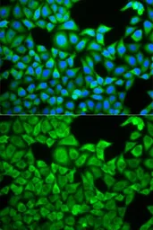 Anti-SLC3A1 antibody used in Immunocytochemistry/ Immunofluorescence (ICC/IF). GTX33506