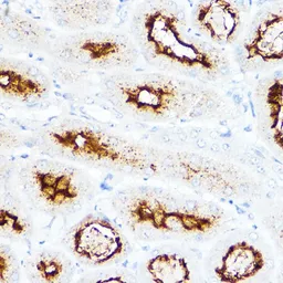 Anti-SLC3A1 antibody used in IHC (Paraffin sections) (IHC-P). GTX33506