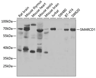 Anti-SMARCD1 antibody used in Western Blot (WB). GTX33507