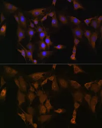 Anti-SND1 antibody used in Immunocytochemistry/ Immunofluorescence (ICC/IF). GTX33508