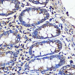 Anti-SND1 antibody used in IHC (Paraffin sections) (IHC-P). GTX33508