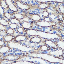Anti-SND1 antibody used in IHC (Paraffin sections) (IHC-P). GTX33508