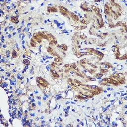 Anti-SND1 antibody used in IHC (Paraffin sections) (IHC-P). GTX33508