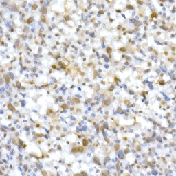 Anti-SNF5 antibody used in IHC (Paraffin sections) (IHC-P). GTX33509