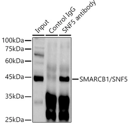 Anti-SNF5 antibody used in Western Blot and Immunoprecipitation (WB IP). GTX33509