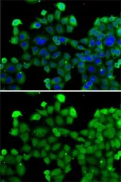 Anti-SNRPD2 antibody used in Immunocytochemistry/ Immunofluorescence (ICC/IF). GTX33510