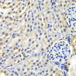 Anti-SNRPD2 antibody used in IHC (Paraffin sections) (IHC-P). GTX33510