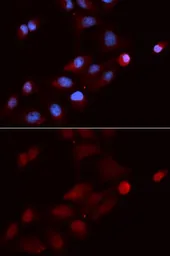 Anti-SNRPE antibody used in Immunocytochemistry/ Immunofluorescence (ICC/IF). GTX33511
