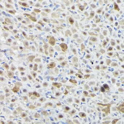 Anti-SNRPE antibody used in IHC (Paraffin sections) (IHC-P). GTX33511