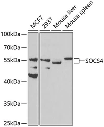 Anti-SOCS4 antibody used in Western Blot (WB). GTX33513