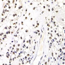 Anti-SOX5 antibody used in IHC (Paraffin sections) (IHC-P). GTX33514
