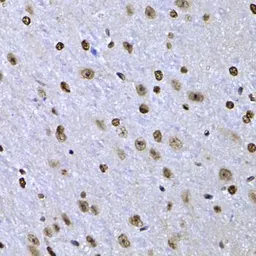 Anti-SOX5 antibody used in IHC (Paraffin sections) (IHC-P). GTX33514