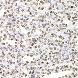 Anti-SOX5 antibody used in IHC (Paraffin sections) (IHC-P). GTX33514