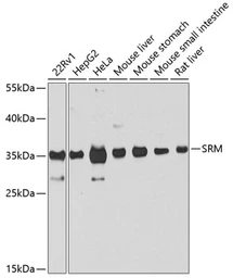 Anti-SRM antibody used in Western Blot (WB). GTX33518