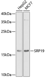 Anti-SRP19 antibody used in Western Blot (WB). GTX33519