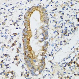 Anti-SRP19 antibody used in IHC (Paraffin sections) (IHC-P). GTX33519