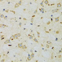 Anti-SRP19 antibody used in IHC (Paraffin sections) (IHC-P). GTX33519
