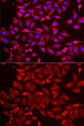 Anti-SRP19 antibody used in Immunocytochemistry/ Immunofluorescence (ICC/IF). GTX33519