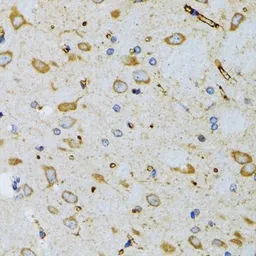 Anti-SRP19 antibody used in IHC (Paraffin sections) (IHC-P). GTX33519