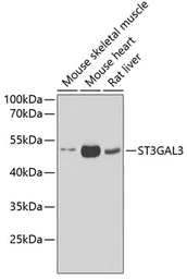 Anti-ST3GAL3 antibody used in Western Blot (WB). GTX33520