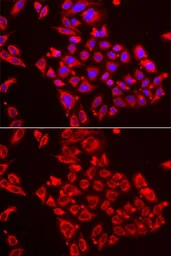 Anti-ST3GAL3 antibody used in Immunocytochemistry/ Immunofluorescence (ICC/IF). GTX33520