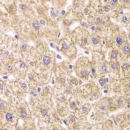 Anti-ST3GAL3 antibody used in IHC (Paraffin sections) (IHC-P). GTX33520