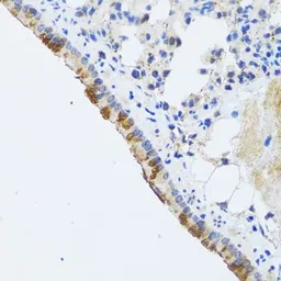 Anti-ST3GAL3 antibody used in IHC (Paraffin sections) (IHC-P). GTX33520