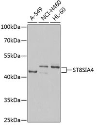 Anti-ST8SIA4 antibody used in Western Blot (WB). GTX33523