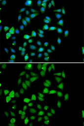 Anti-STAMBP antibody used in Immunocytochemistry/ Immunofluorescence (ICC/IF). GTX33524