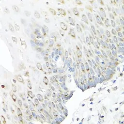 Anti-Staufen antibody used in IHC (Paraffin sections) (IHC-P). GTX33527