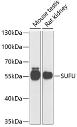 Anti-Suppressor of Fused antibody used in Western Blot (WB). GTX33530