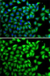 Anti-Suppressor of Fused antibody used in Immunocytochemistry/ Immunofluorescence (ICC/IF). GTX33530
