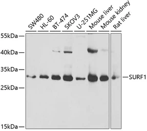 Anti-SURF1 antibody used in Western Blot (WB). GTX33531