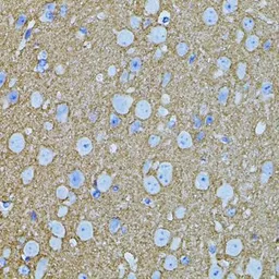 Anti-Syntaxin 1a antibody used in IHC (Paraffin sections) (IHC-P). GTX33532
