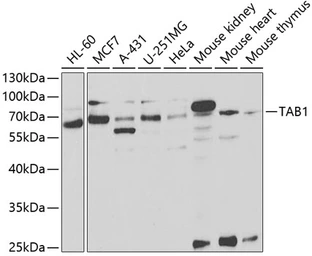Anti-TAB1 antibody used in Western Blot (WB). GTX33533