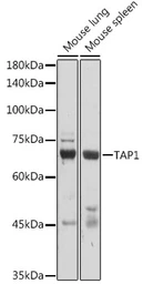 Anti-TAP1 antibody used in Western Blot (WB). GTX33534