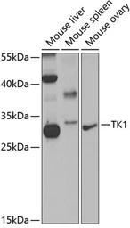Anti-Thymidine Kinase 1 antibody used in Western Blot (WB). GTX33544
