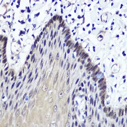 Anti-Thymidine Kinase 1 antibody used in IHC (Paraffin sections) (IHC-P). GTX33544